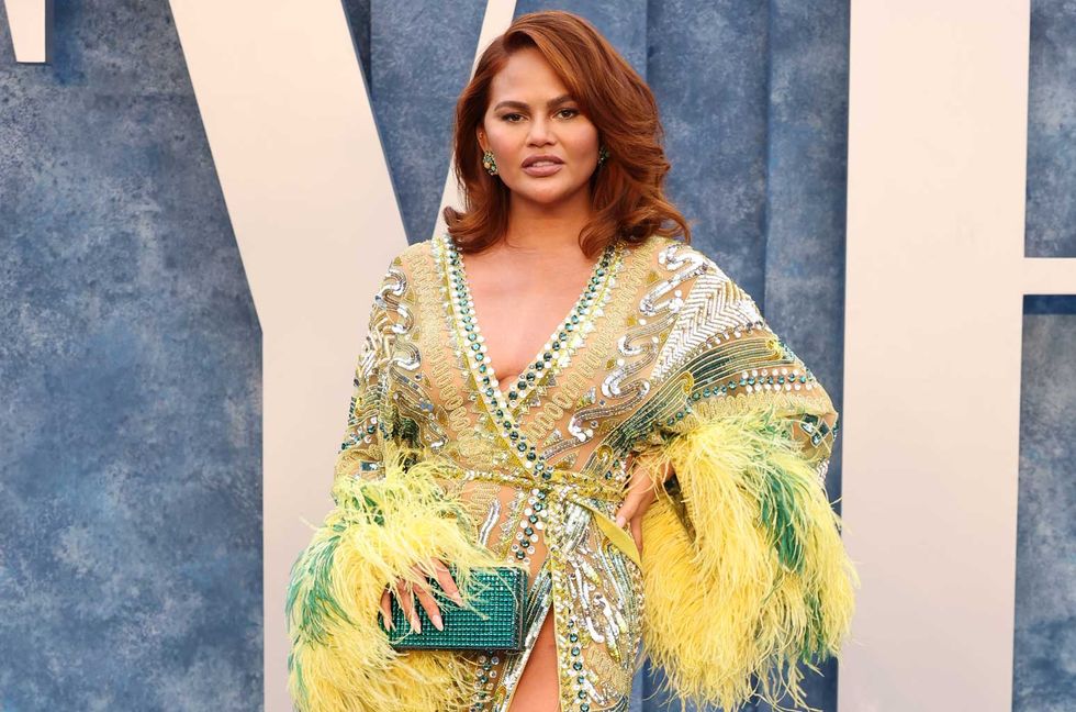 Chrissy Teigen Shares C-Section Photo in Response to Strange Claim That She Was ‘Born Male’ & Faked Her Pregnancy