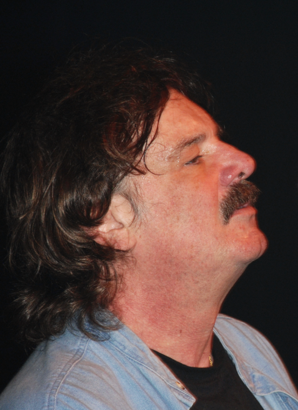 Burton Cummings Shares His Pain Following Accident