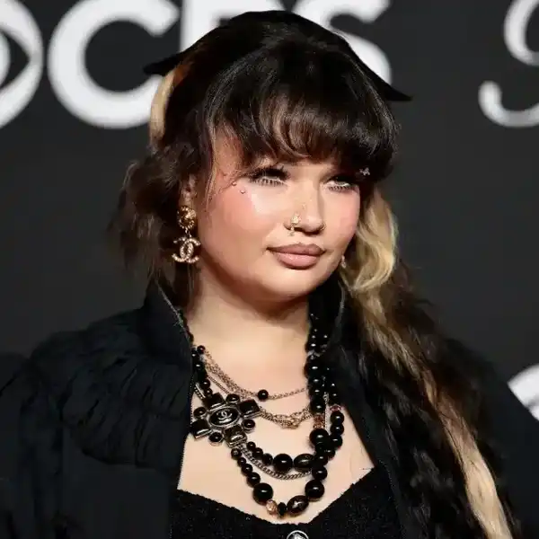 Lola Young Announces She’s ‘Going Away for a While’ to ‘Work on Myself’ After Collapsing On Stage